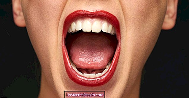 odontoiatria - Tutto quello che devi sapere sull'alitosi