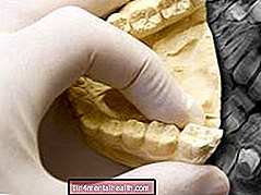 Måter å lindre smertefulle visdomstenner på - tannbehandling