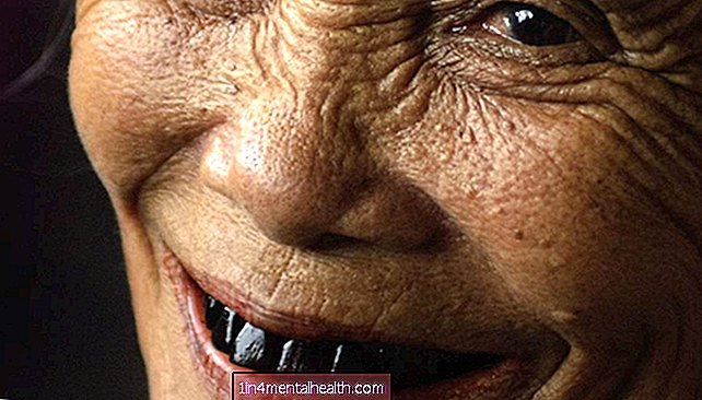 Apa yang menyebabkan gigi menjadi hitam? - kedokteran gigi