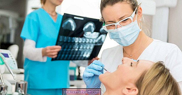 Hva å vite om tannimplantater - tannbehandling