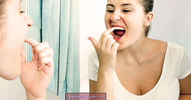 Kas jāzina par plaisu mēli - zobārstniecība