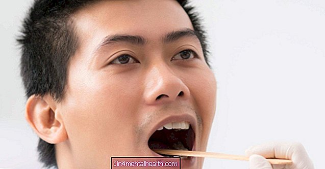 Kodėl kraujuoja liežuvis? - odontologija