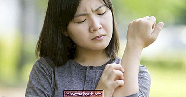 10 huiduitslag veroorzaakt door colitis ulcerosa - dermatologie