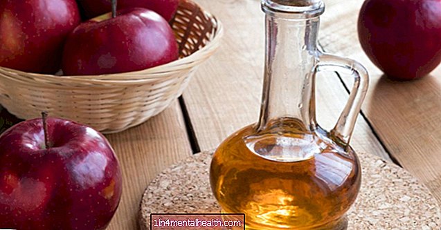 Да ли јабуков сирћет може да лечи брадавице? - дерматологија