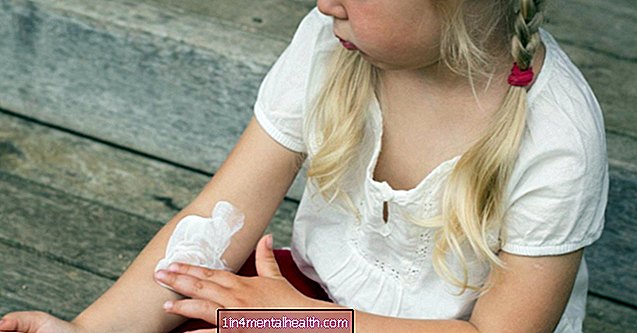 Otroški ekcem in astmo lahko z novim zdravljenjem olajšamo