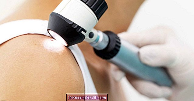 Běžné kožní bakterie mohou zabránit rakovině kůže