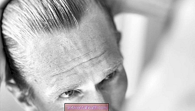 Rambut rontok: Petunjuk ditemukan di telapak tangan Anda - dermatologi