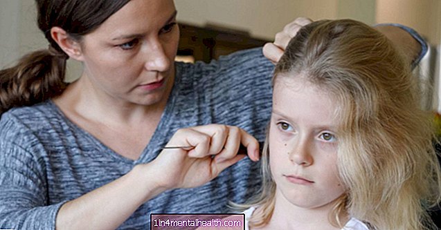 Pérdida de cabello en niños: lo que debe saber