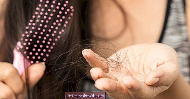 HIV in izguba las: Kaj je povezava?