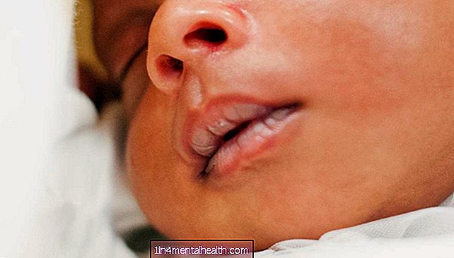 新生児の荒れた唇を治療する方法