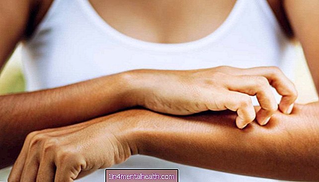 قد تؤدي بعض حمية الكيتو إلى تفاقم التهاب الجلد