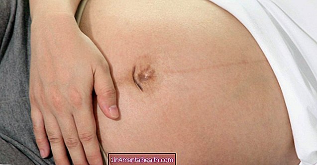 Quali sono le cause del dolore all'ombelico durante la gravidanza?