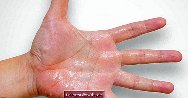 Apa yang menyebabkan kulit berkeringat?