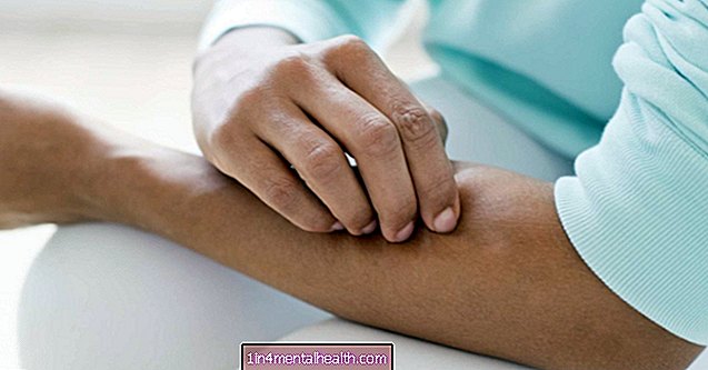 Kaj morate vedeti o glivičnih okužbah - dermatologija
