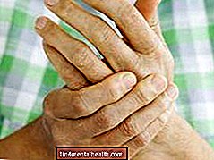 Какво трябва да знаете за инфекцията на пръстите? - дерматология
