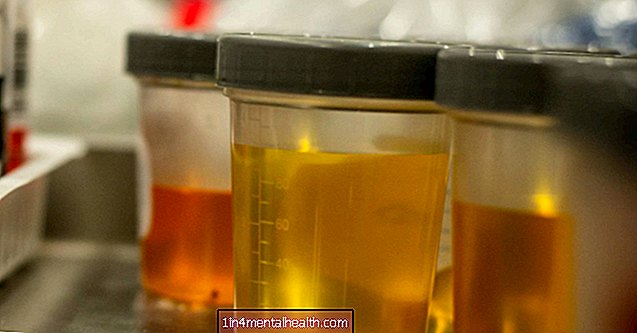 Vse, kar morate vedeti o analizi urina - diabetes