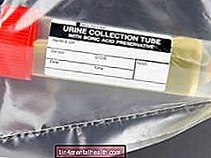 Tes urine untuk diabetes: Apa yang perlu Anda ketahui