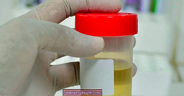 Kaj je test specifične teže urina?