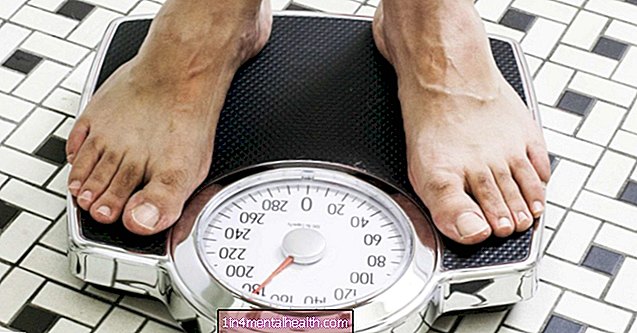 Kas yra metaboliškai sveikas nutukimas?