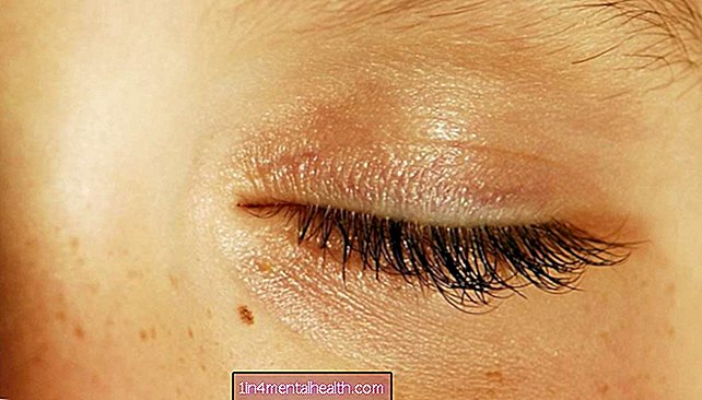 Jedenáct příčin bolesti při blikání - suché oko