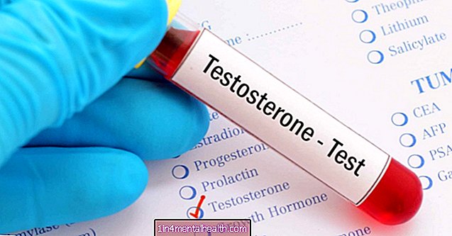 Tipične ravni testosterona pri moških in ženskah