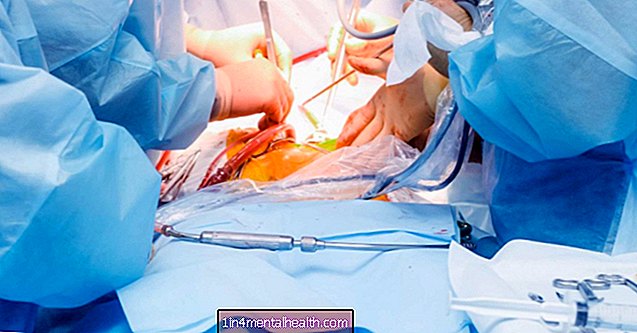 Co lze očekávat od laparoskopie pro endometriózu - endokrinologie