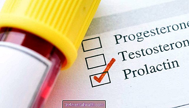 Miks tehakse prolaktiini taseme test? - endokrinoloogia