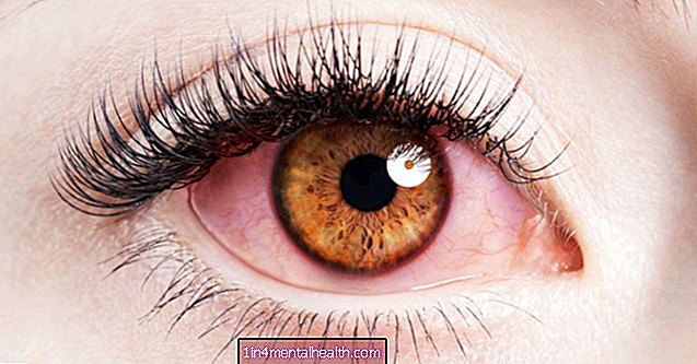 Badania pokazują, że uporczywy stres może prowadzić do utraty wzroku - zdrowie oczu - ślepota