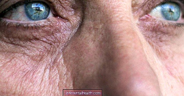 Які найкращі вітаміни для здоров’я очей? - здоров'я очей - сліпота