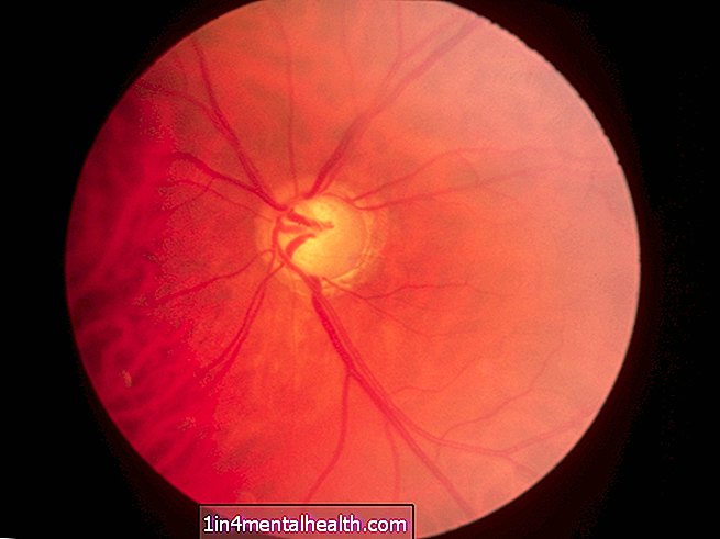 eye-health--blindness - O que é glaucoma?
