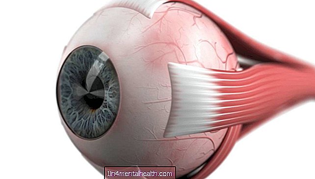 Co należy wiedzieć o chorobie Devica? - zdrowie oczu - ślepota