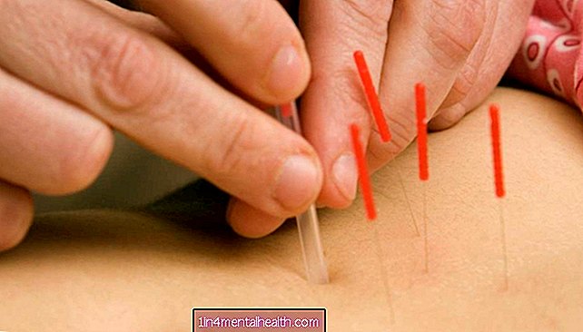 Kan akupunktur förbättra fertiliteten? - fertilitet