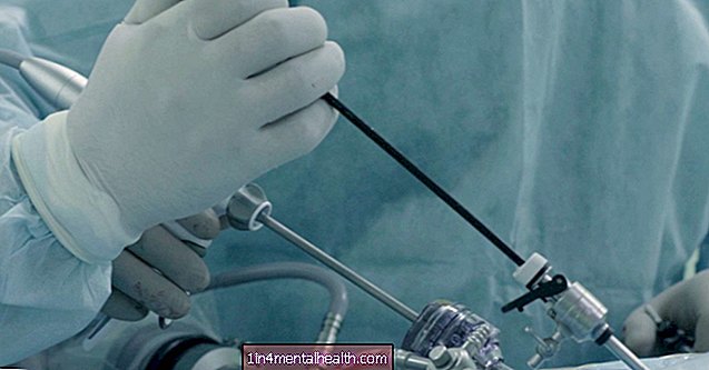 Vse, kar morate vedeti o laparoskopiji - plodnost