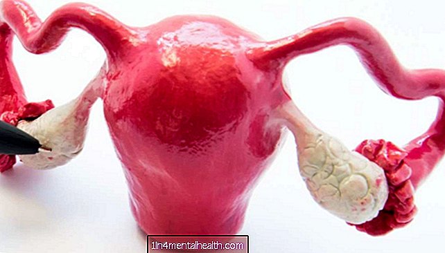 Torsione ovarica: tutto ciò che devi sapere