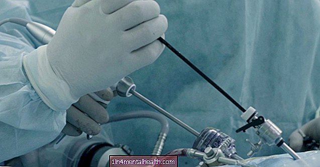 Kaj vedeti o laparoskopiji za neplodnost