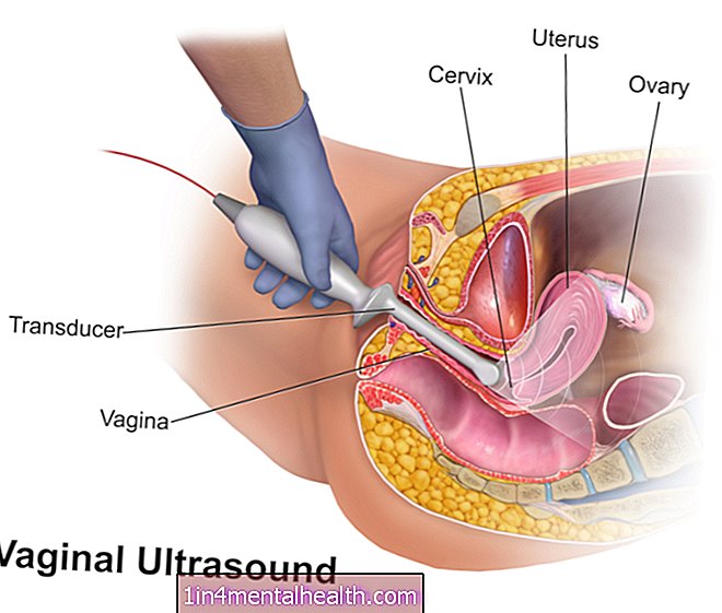Transvajinal ultrasonlar hakkında bilinmesi gerekenler