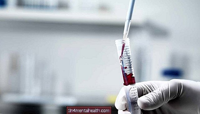 Verdens første diagnostiske blodprøve for cøliaki i syne - mad-intolerance