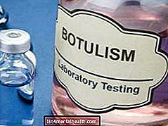 Botulizmus: Čo to je a ako tomu môžeme zabrániť? - gastrointestinálne - gastroenterológia