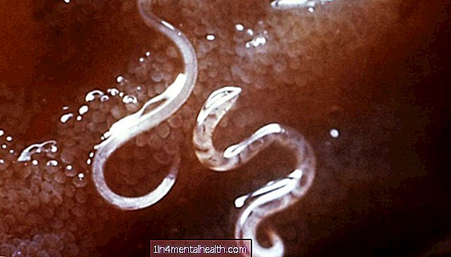 Intestinale wormen bij mensen en hun symptomen