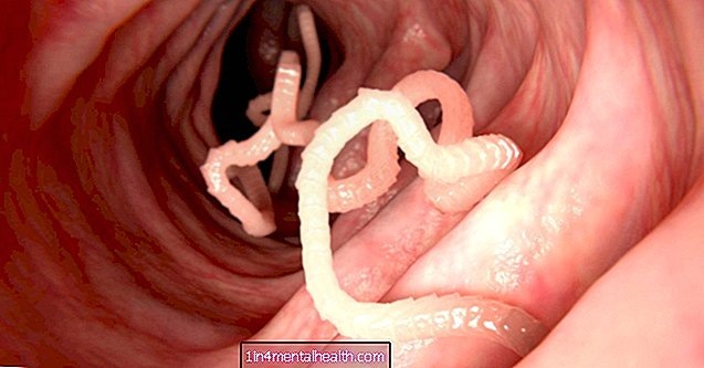 Hvad forårsager hvide pletter i min poop? - gastrointestinal - gastroenterologi