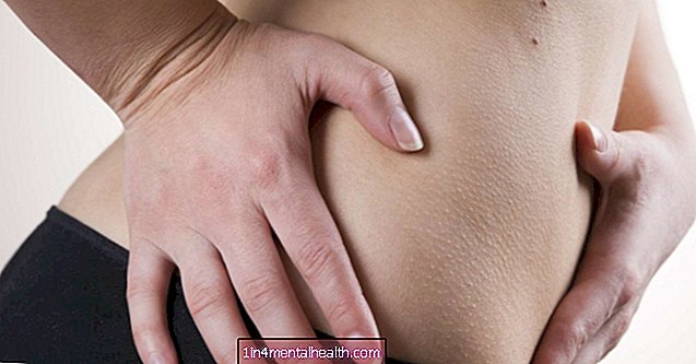Aká je to bolesť v pravom dolnom bruchu? - gastrointestinálne - gastroenterológia