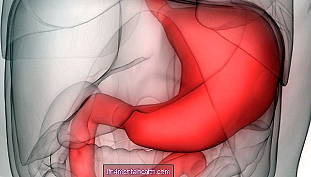 Mida teada atroofilise gastriidi kohta