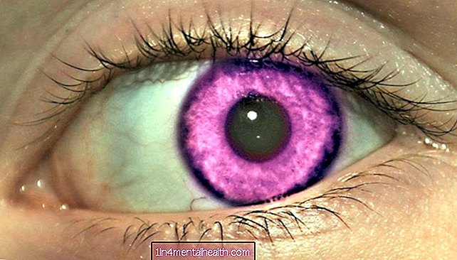 Kan ögonen verkligen bli lila? - genetik