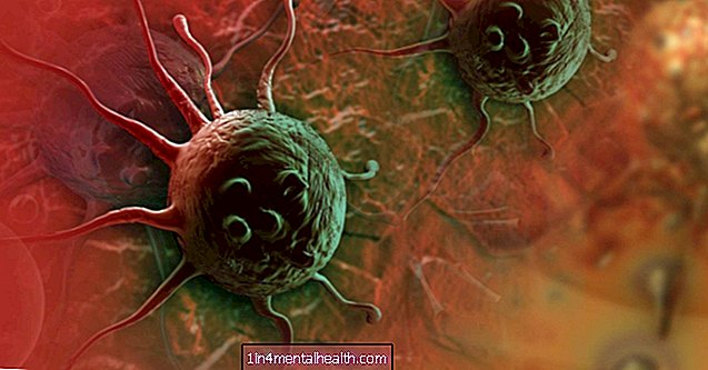 Rak: nowy cel znaleziony dla nowotworów lekoopornych