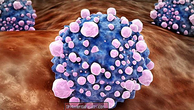 Le cellule tumorali del pancreas si diffondono "istruendo" l'ambiente tumorale - genetica