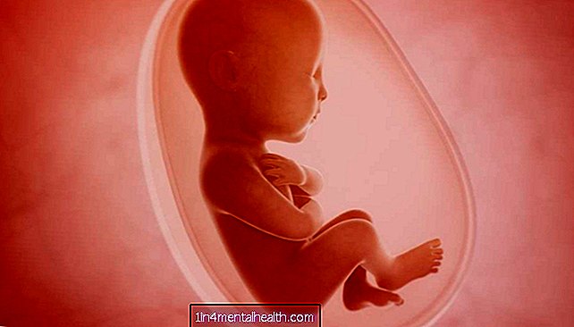 統合失調症：胎盤がリスクを説明する可能性があります