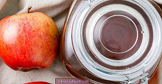 Ali lahko jabolčni kis zdravi protin? - protin