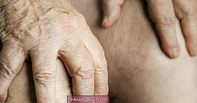 Revmatoid artritt vs. gikt: symptomer og årsaker - gikt