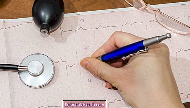 Kako zdravnik diagnosticira atrijsko fibrilacijo? - srčna bolezen