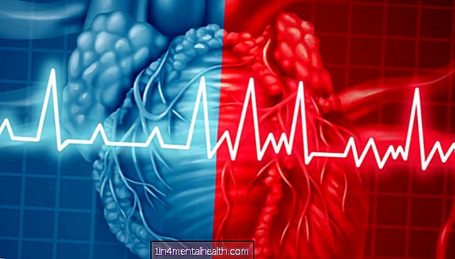 Aké sú typy predsieňovej fibrilácie? - ochorenie srdca